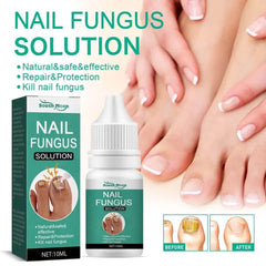 Nail Fungus Removal Gel