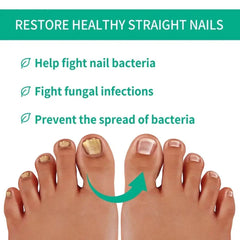 Nail Fungus Removal Gel