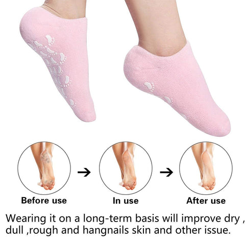 Cracked Heels Moisturizing Gel Socks