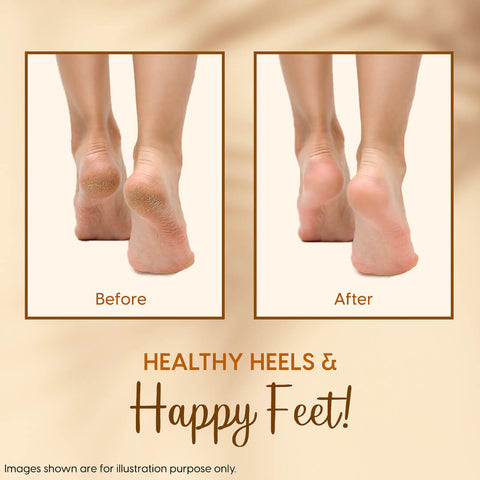 Full Silicone Gel Heel Protector Socks