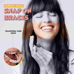 Original Snap-On Smile Braces