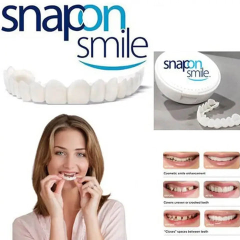 Original Snap-On Smile Braces